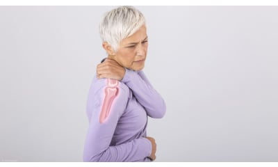 Bild zu Frozen Shoulder – Symptome, Ursachen & Therapien