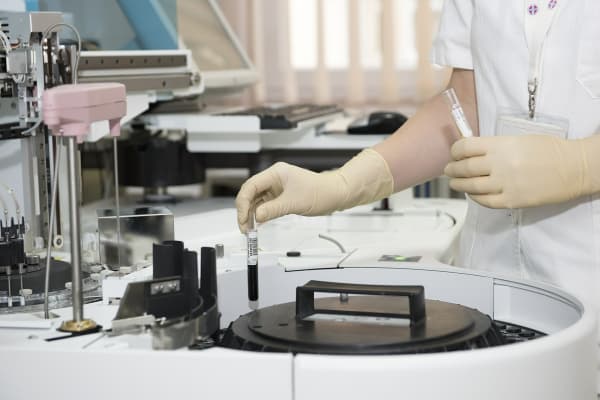 Salmonella Agona-Ausbruch: Ursache verzehrsfertige Lebensmittel?