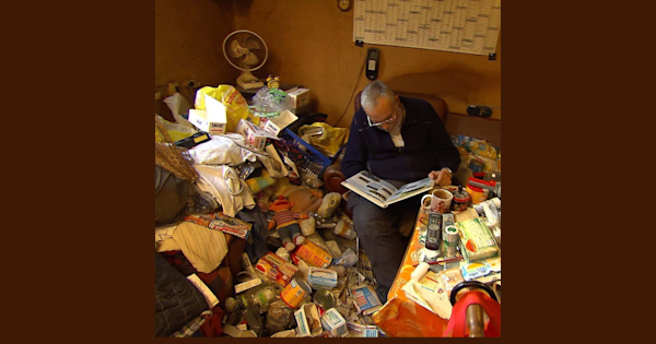 Фетальный алкогольный синдром плода. Синдром мессии. Синдром шершеаского тернера. Синдром мессии. Симптомы и синдромы поражения среднего мозга.