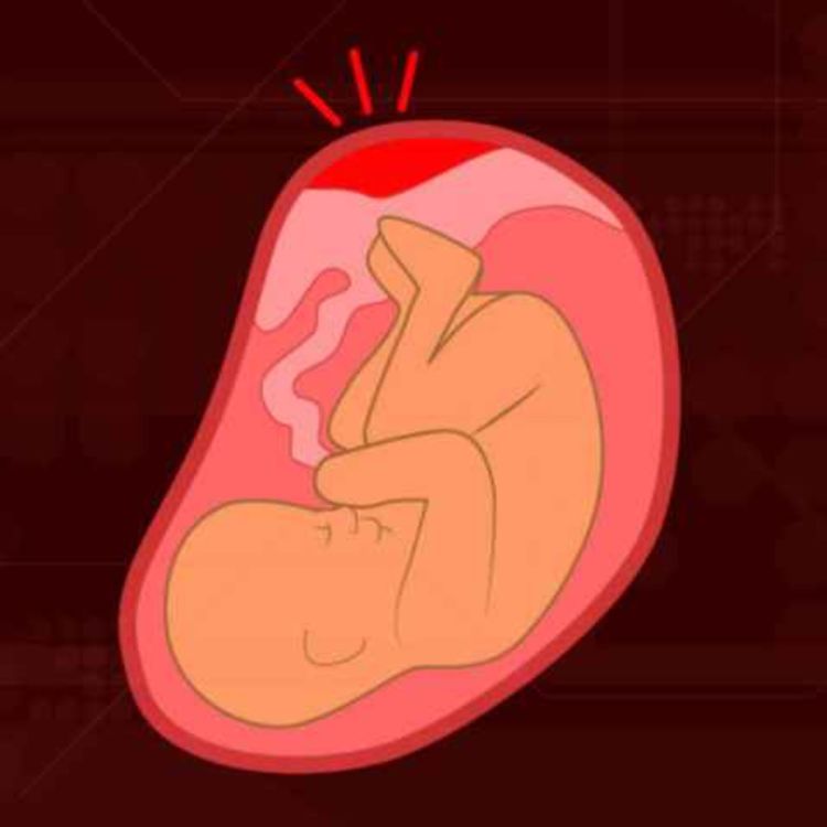 cover art for Placenta Issues | Michigan Medicine