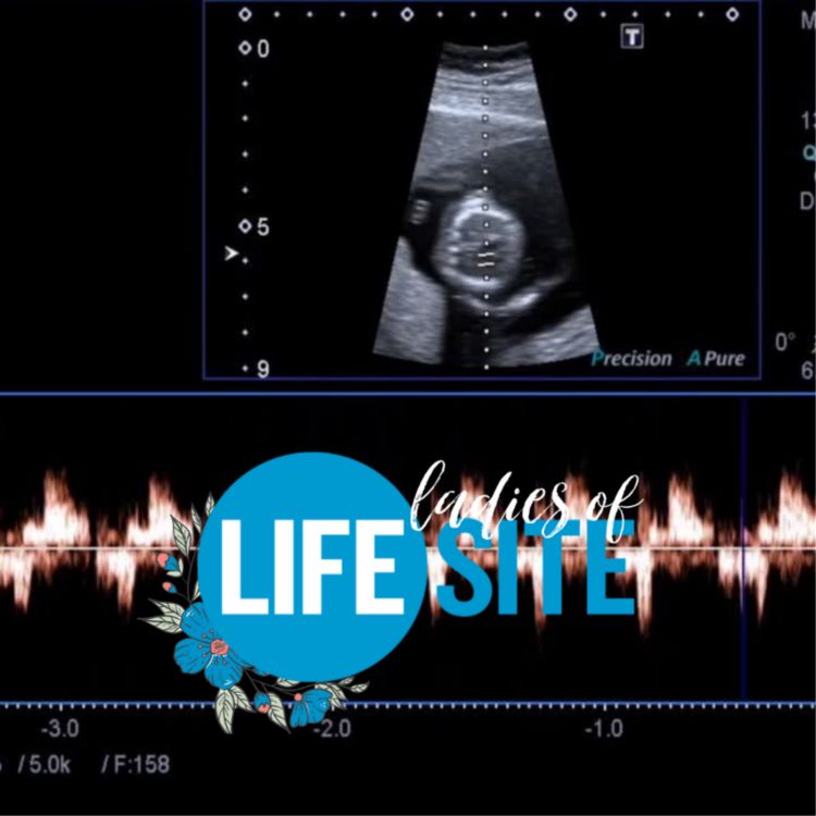 cover art for Texas Heartbeat Law: Expert lawyer weighs in on what this means for Roe and the Pro-Life movement