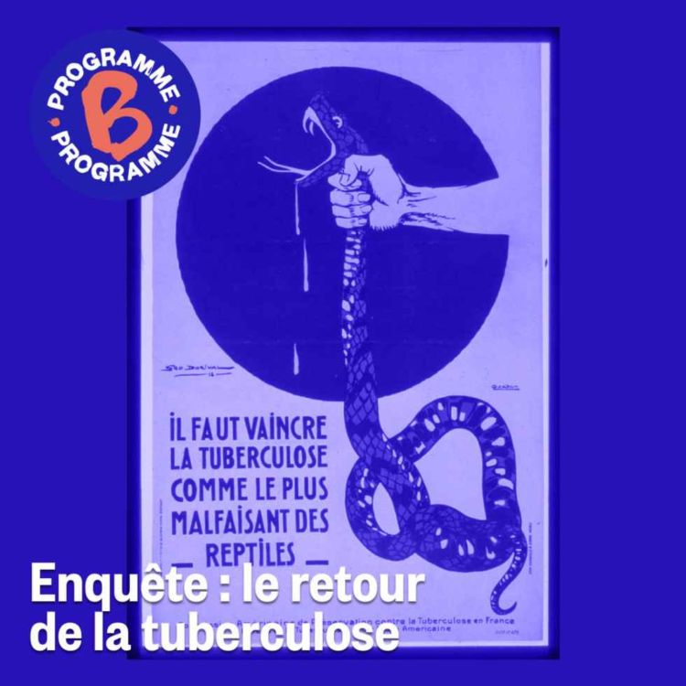 cover art for Enquête : le retour de la tuberculose | 2/3