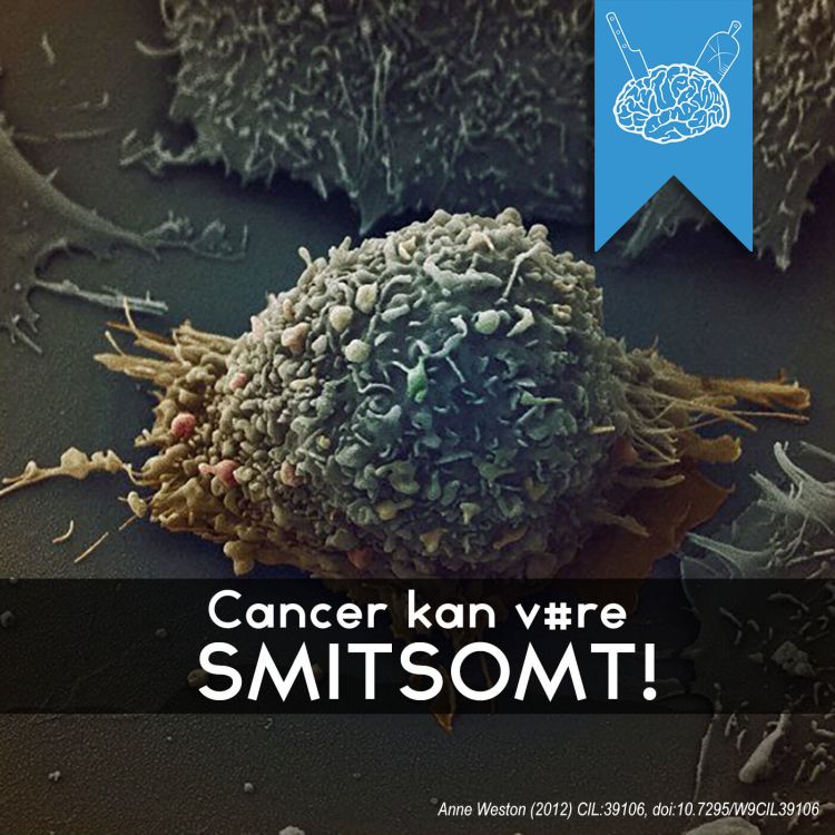 cover art for #3.58: Cancer kan være smitsomt!