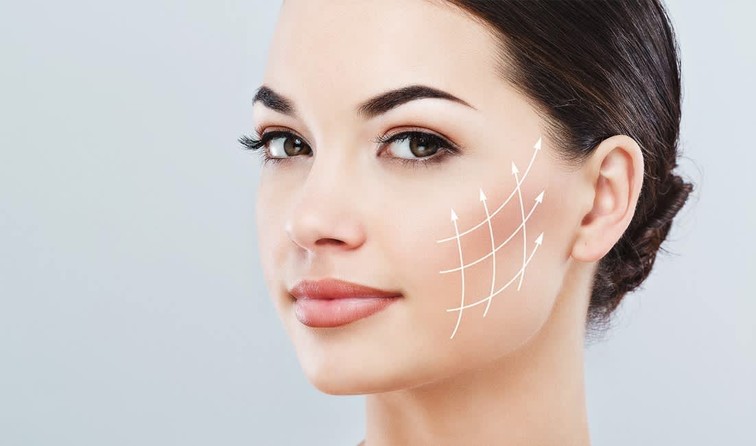 Face lift surgery