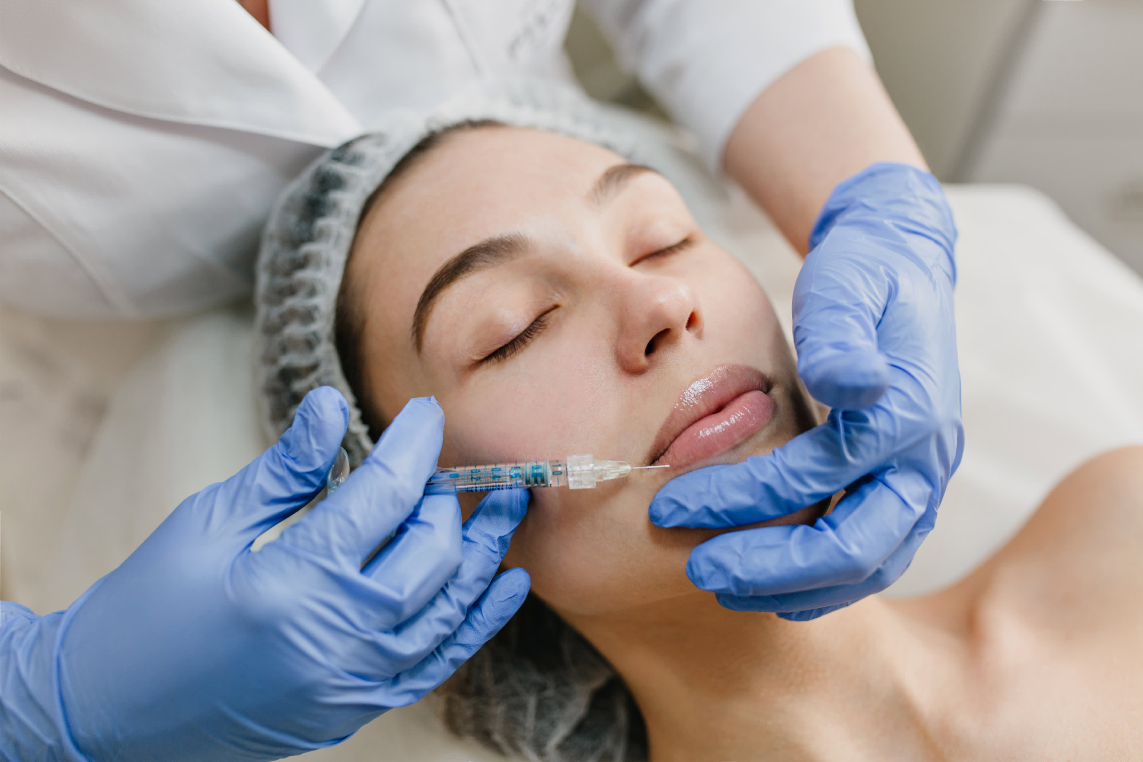 Lip augmentation surgery