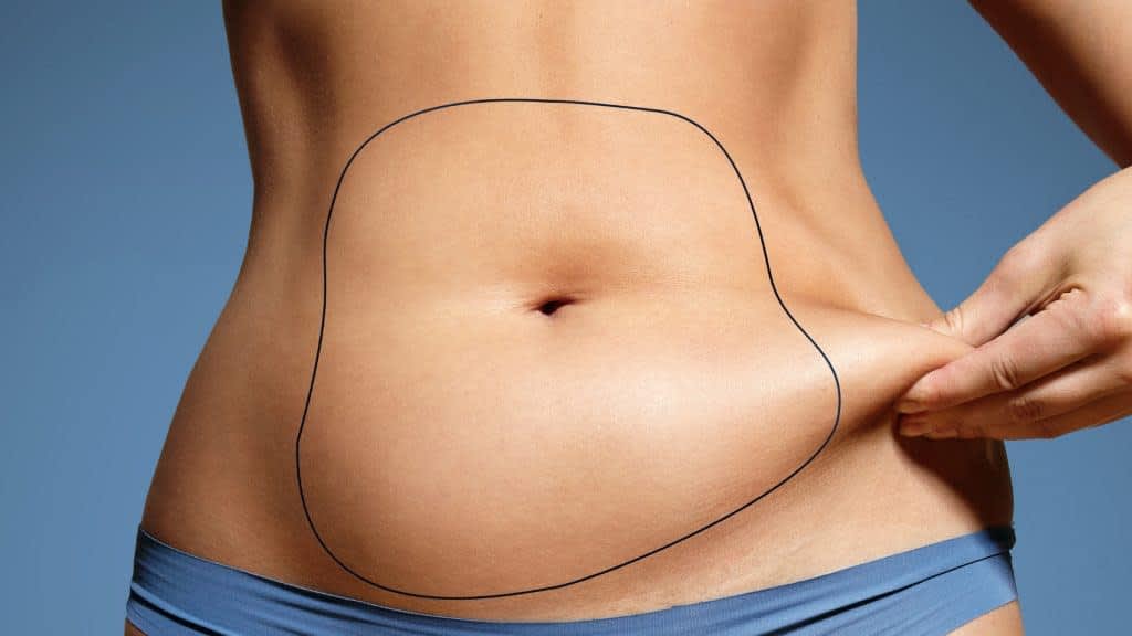 Liposuction abdomen — treatment planning