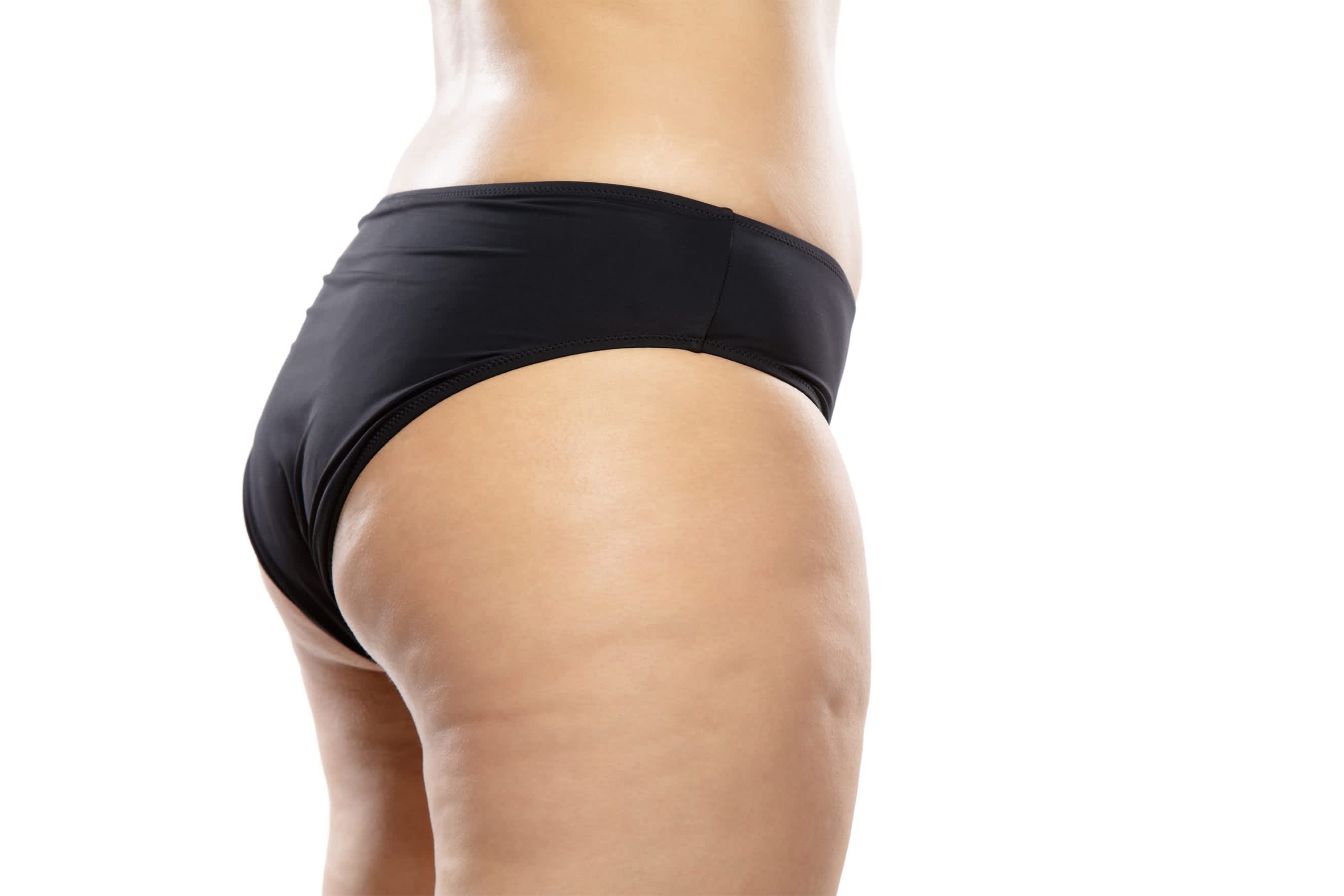 Thigh lift surgery