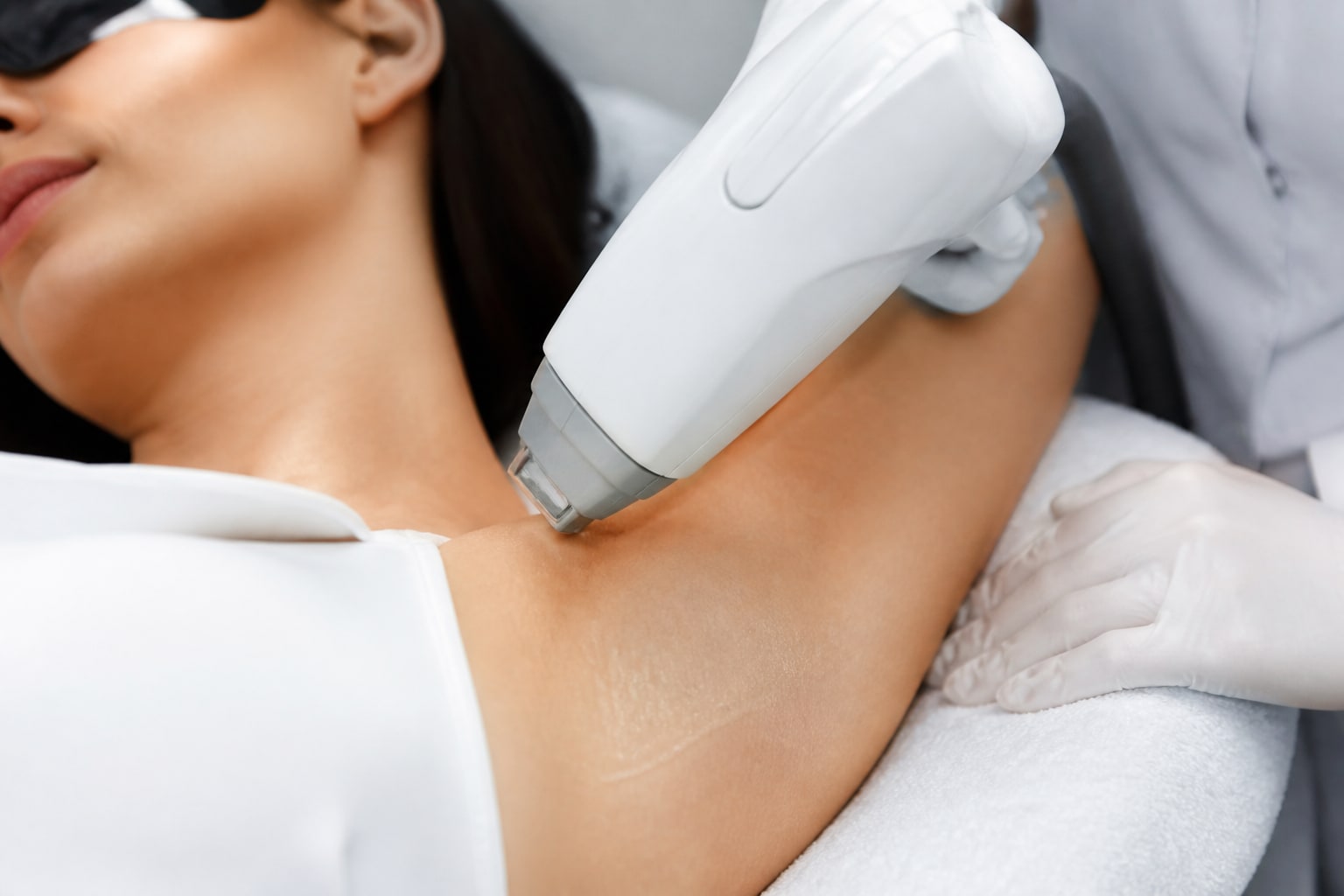 Underarm laser hair reduction at Revive61
