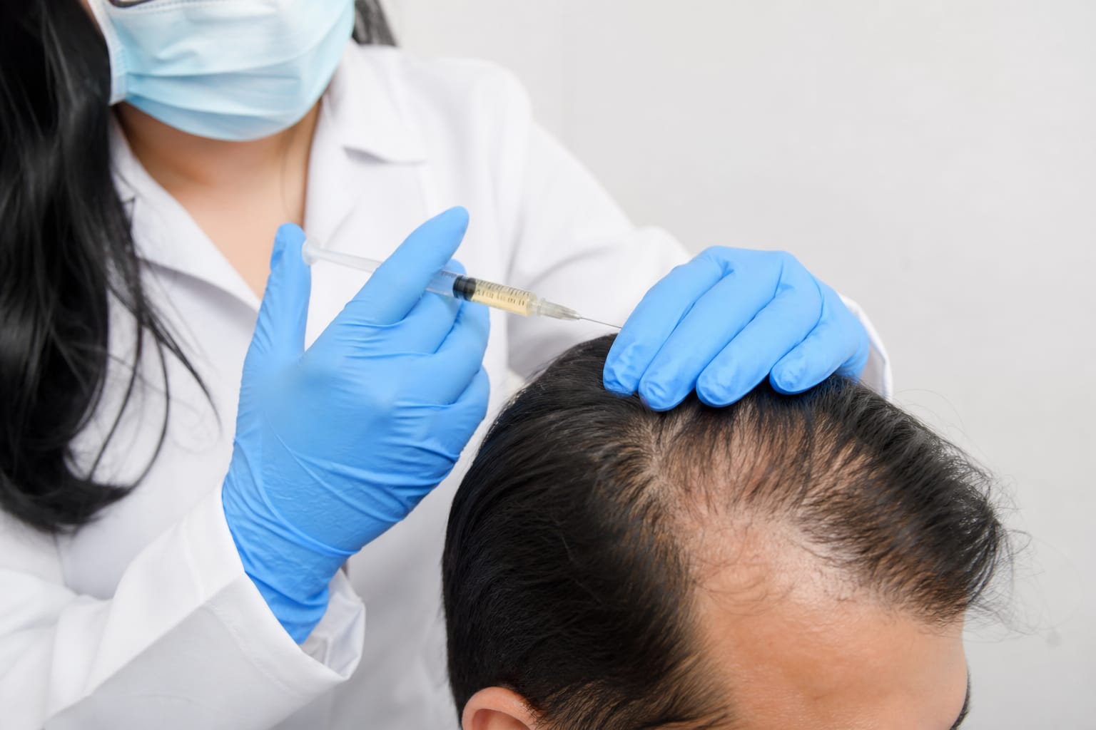 PRP hair treatment being performed — scalp injection with centrifuge and platelet preparation at Revive61
