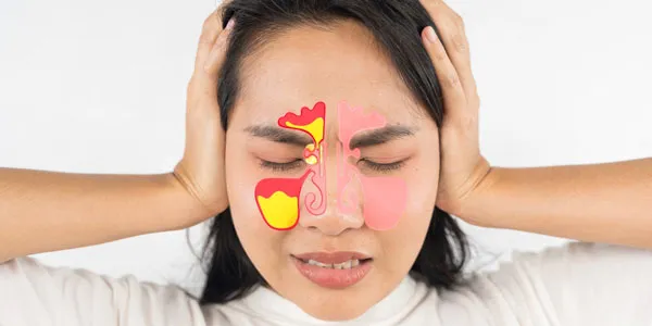 Sakit kepala belakang pada sinusitis