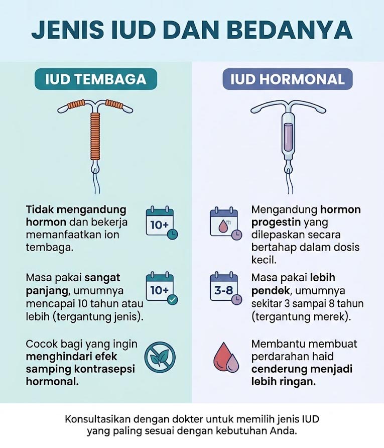 Jenis IUD dan Bedanya