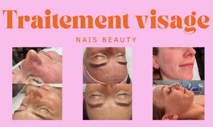Naïs Beauty — Diagnostic & Soin Visage Sur-Mesure Marseille : Manucure à Marseille