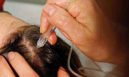Facialiste Paris 8 Ruth Niddam | Kobido | Microneedling : Institut de beauté à Paris