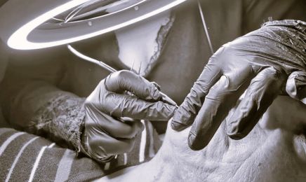 New Derma - Épilation Laser, Électrolyse - Carpentras : Institut de beauté à Carpentras