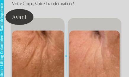Carole Lipocavitation  : Institut de beauté à Bourges