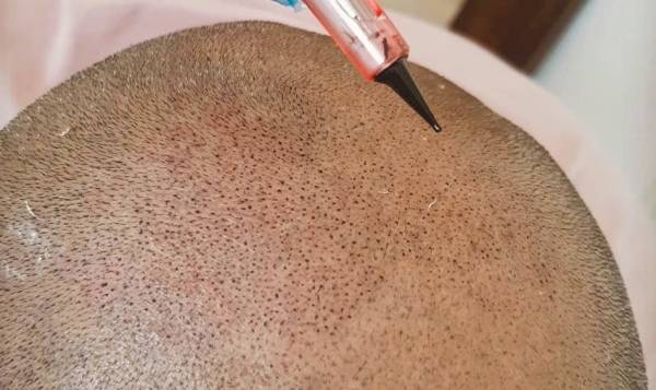 LM Dermopigmentation Réparatrice 