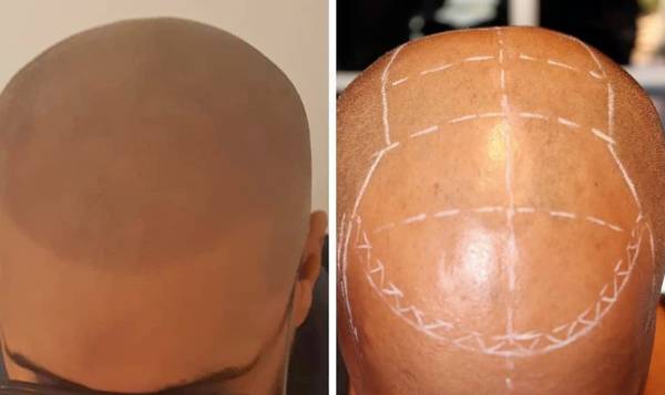 LM Dermopigmentation Réparatrice 