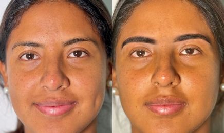 Limei Esthétique : Institut de beauté à Cuers