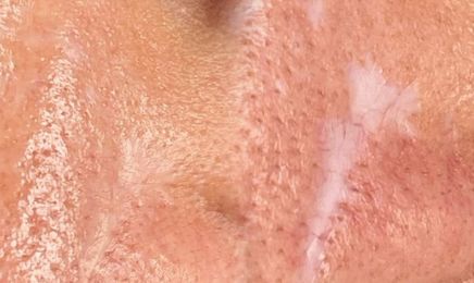 Trait Délicat : Institut de beauté à Montluçon