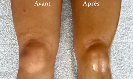 Drainamath : Institut de beauté à Marseille