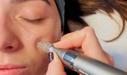 DERMOPURE - Centre Épilation Laser & Cryolipolyse : Institut de beauté à Lyon