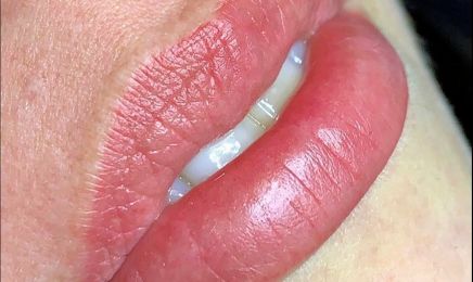 DERMATELIER : Institut de beauté à Neuilly-Plaisance