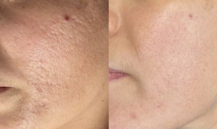 B-Otyskin Skincare : Institut de beauté à Ivry-sur-Seine
