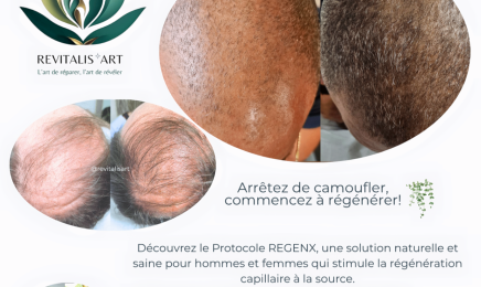 Revitalis'Art - Alopécie - Prothèse aréoles mammaires - Dermopigmentation correctrice : Coiffeur à Rivière-Salée