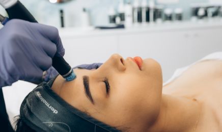 SUBLIMA - laser, détatouage, injections : Institut de beauté à Geispolsheim