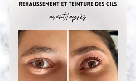 Alyna (Microneedling...) : Institut de beauté à Toulon