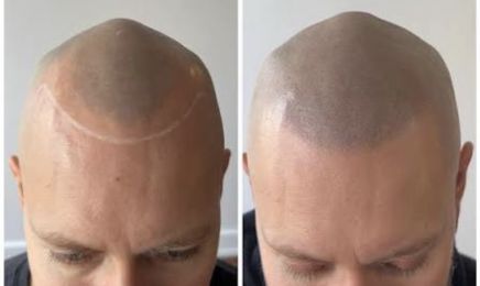 Lucine - Centre de dermopigmentation & Maquillage semi-permanent : Institut de beauté à Les Sables-d'Olonne