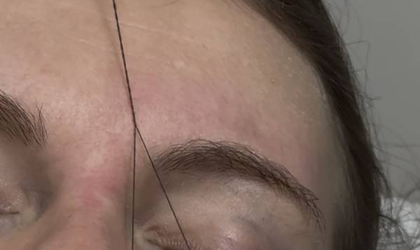 Sonya Tahan - Laser & Beauty