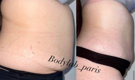 Body Lab. Paris : Institut de beauté à Pantin