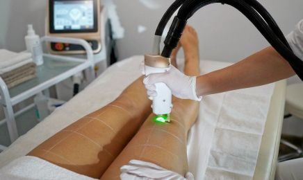 DERMALYSS - Epilation au laser médical - Thermolyse : Manucure à L'Isle-sur-la-Sorgue