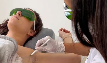 Épilation Laser, Cryolipolyse & Radiofréquence Visage & Corps - Maison Lijam : Institut de beauté à Eysines
