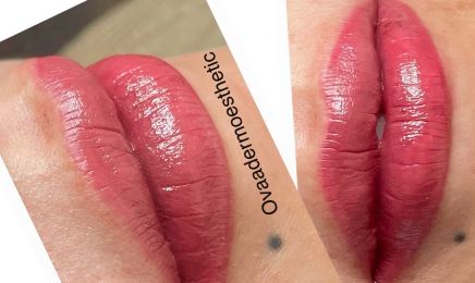 OVAdermoesthetic : Institut de beauté à Choisy-le-Roi