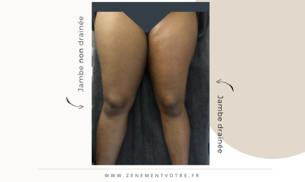 Zenement Vôtre - Toulouse : Institut de beauté à Toulouse