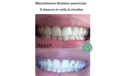 Kenze Naturel Piercing et Beauté : Manucure à Tours