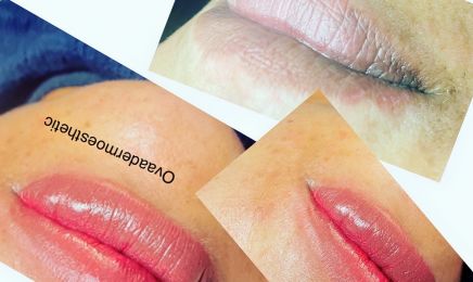 OVAdermoesthetic : Institut de beauté à Choisy-le-Roi