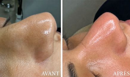 Skin excellence : Institut de beauté à Tonnay-Charente