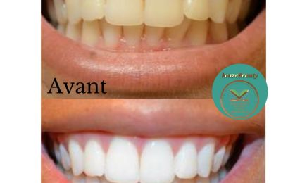 Kenze Naturel Piercing et Beauté : Manucure à Tours