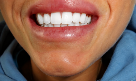 Smile Edit & Nailys Beauty  : Manucure à Villefranche-sur-Saône