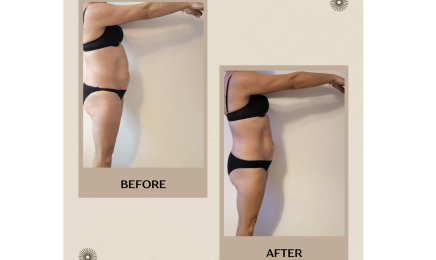 Body Skin Beauty By Angie : Spa à Boissy-le-Châtel