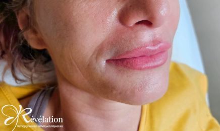 Révélation : Institut de beauté à Albi