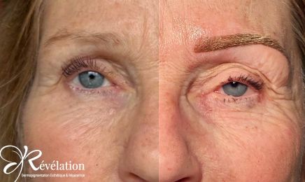Révélation : Institut de beauté à Albi