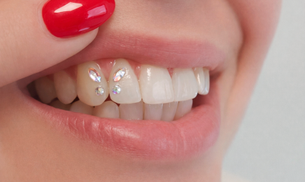 M’Sourire & Cils Jo By Laetitia • Blanchiment & Strass Dentaire - Cils & Sourcils  : Manucure à Bruz