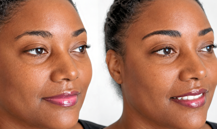 PIGMADERM BEAUTE  : Institut de beauté à Saint-Martin-Longueau