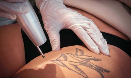 Centre Laser du Rempart : Institut de beauté à Colmar