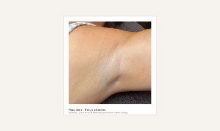 Expertise Laser : Institut de beauté à Verton
