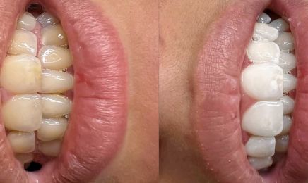 Beauty Glow  : Manucure à Compiègne